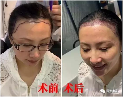 default/20190627/23d55de5ef962abdea5b75f5c108eb02.png