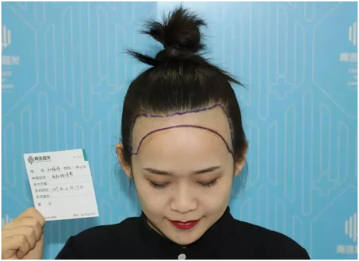 default/20190715/1b7cb26d73b264a134d929f1cb36a641.png
