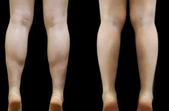 一兆韦德4个减掉大腿内侧赘肉的有效动作练出超模腿