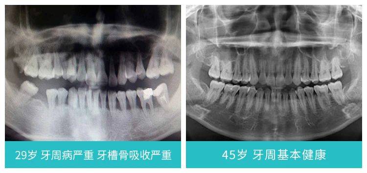 什么年龄做牙齿矫正好？柏德口腔康祖铭博士讲解矫牙黄金年龄段