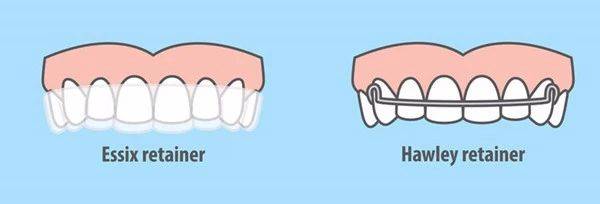 牙齿矫正保持器要戴多久?柏德口腔详解各类正畸保持器 牙齿矫正